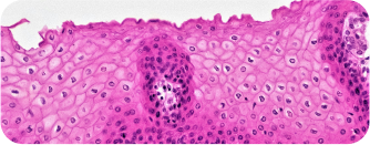 Teaser_Histomography